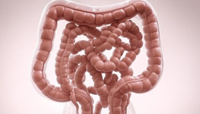 cancer-no-intestino-grosso-a-forca-do-agro.jpg