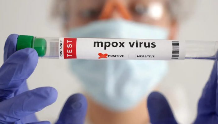 2024-08-20t140130z_1463373049_rc2pj9a34q6t_rtrmadp_3_health-mpox.jpg 2024-08-20t140130z_1463373049_rc2pj9a34q6t_rtrmadp_3_health-mpox.jpg