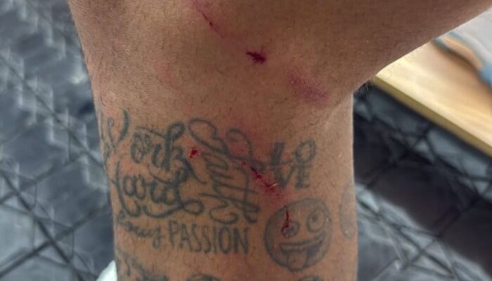 Neymar-foto-joelho-700×441.jpeg Neymar-foto-joelho-700x441.jpeg