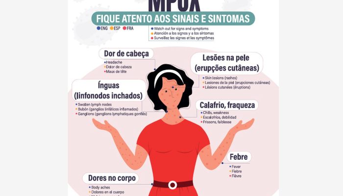 mpox_fique_atento_aos_sinais.jpg